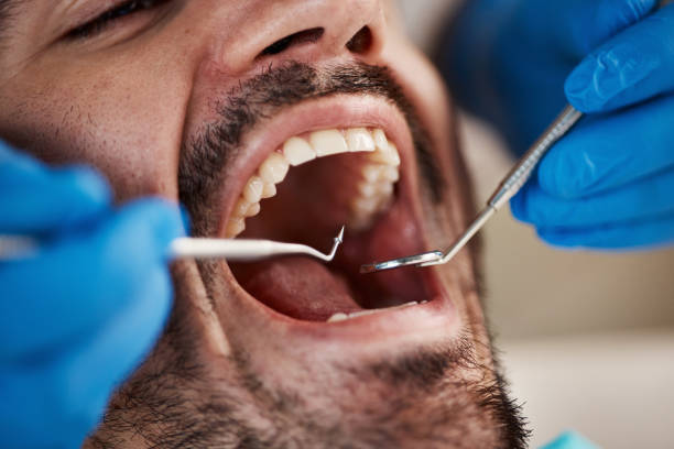 Best Knocked-Out Tooth Emergency  in Big Spring, TX